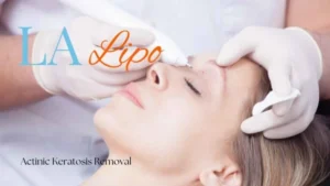 Woman receiving Actinic Keratosis Removal Treatment Malmesbury