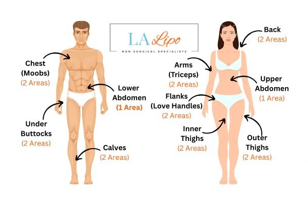 LA LIPO Cryolipolysis Areas Malmesbury