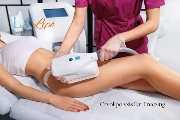 Woman receiving coolsculpting Malmesbury treatment on her thighs