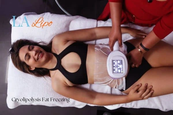 woman getting cryolipolysis Malmesbury